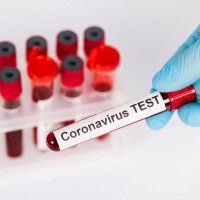 Przeciwciała anty SARS-CoV-2 metodą jakościową w klasie IgG koronawirus