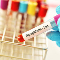 Marker Tyreoglobulina