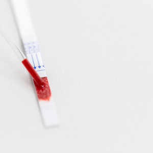 Anty HCV - badanie laboratoryjne