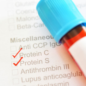 aptt-badanie-laboratoryjne-etermed APTT - badanie laboratoryjne