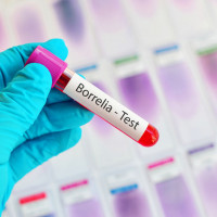 Borelioza - pakiet podstawowy (IgG i IgM)