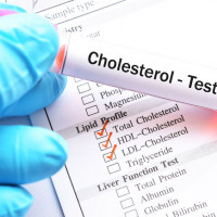 Cholesterol HDL - badanie laboratoryjne