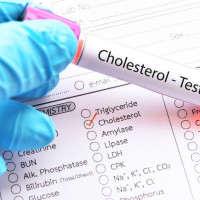 Cholesterol LDL - badanie laboratoryjne