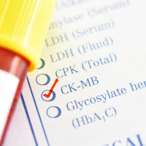 ck-kinaza-fosfokreatynowa-badanie-laboratoryjne-etermed CK (kinaza fosfokreatynowa) - badanie laboratoryjne