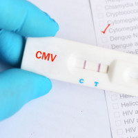 CMV IgM (cytomegalia IgM) - badanie laboratoryjne