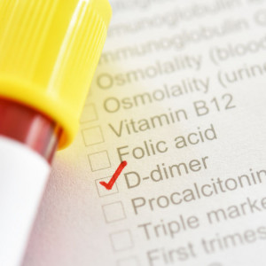 d-dimer-badanie-laboratoryjne-etermed D-dimer - badanie laboratoryjne