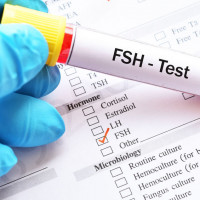 FSH - badanie laboratoryjne