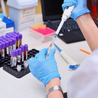 HIV - badanie laboratoryjne