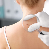 Komfortowy pakiet markery nowotworowe dla kobiet