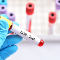 LDH - badanie laboratoryjne