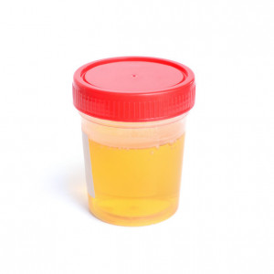 mocz-metoksykatecholaminy-etermed Mocz - metoksykatecholaminy