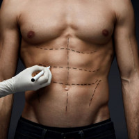 Pakiet przed zabiegiem chirurgicznym komfortowy