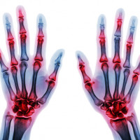 Pakiet reumatologiczny