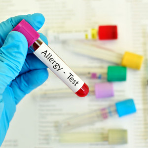 panel-alergiczny-fx22-orzechy-mix-2-etermed Panel alergiczny FX22 ORZECHY MIX 2