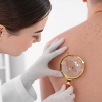 Porada dermatologiczna