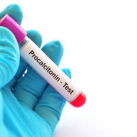 Marker Prokalcytonina