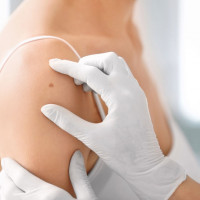 Rozszerzony pakiet markery nowotworowe - kobiece narządy płciowe