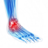 RTG stawu skokowego AP + bok