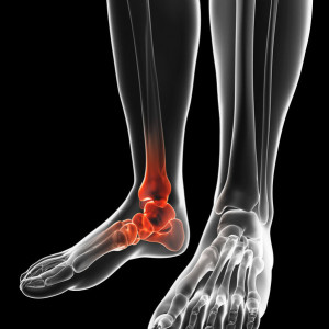 rtg-stopy-ap-skos-etermed RTG stopy (AP + skosy)