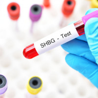 SHBG - badanie laboratoryjne