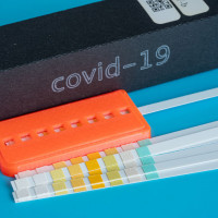 Test COVID-19 RT PCR z wymazu (genetyczny)