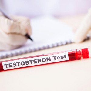 Testosteron - badanie laboratoryjne