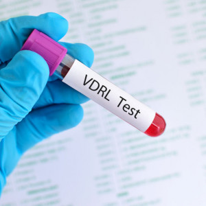 vdrl-jakościowo-etermed VDRL jakościowo