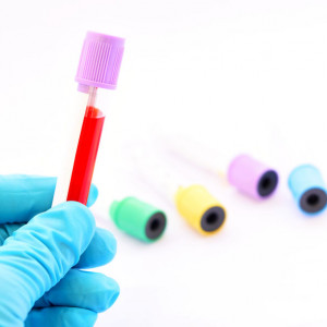 wapń-zjonizowany-badanie-laboratoryjne-etermed Wapń zjonizowany - badanie laboratoryjne