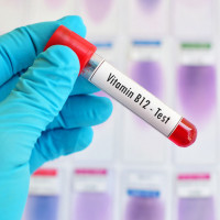 Witamina B12 - badanie laboratoryjne